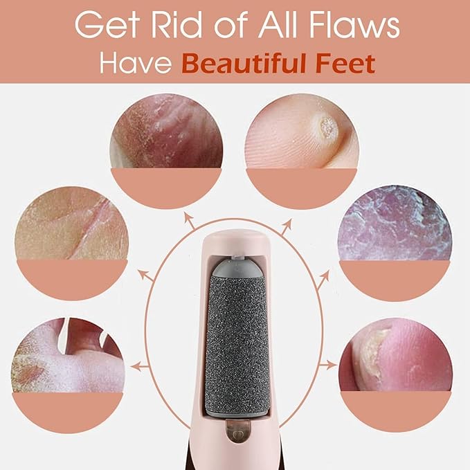 Arkis™ Pro Electric Callus Remover | Rechargeable Pedicure Device for Smooth & Crack-Free Feet
