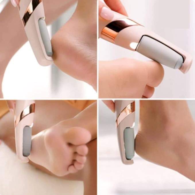 Arkis™ Pro Electric Callus Remover | Rechargeable Pedicure Device for Smooth & Crack-Free Feet